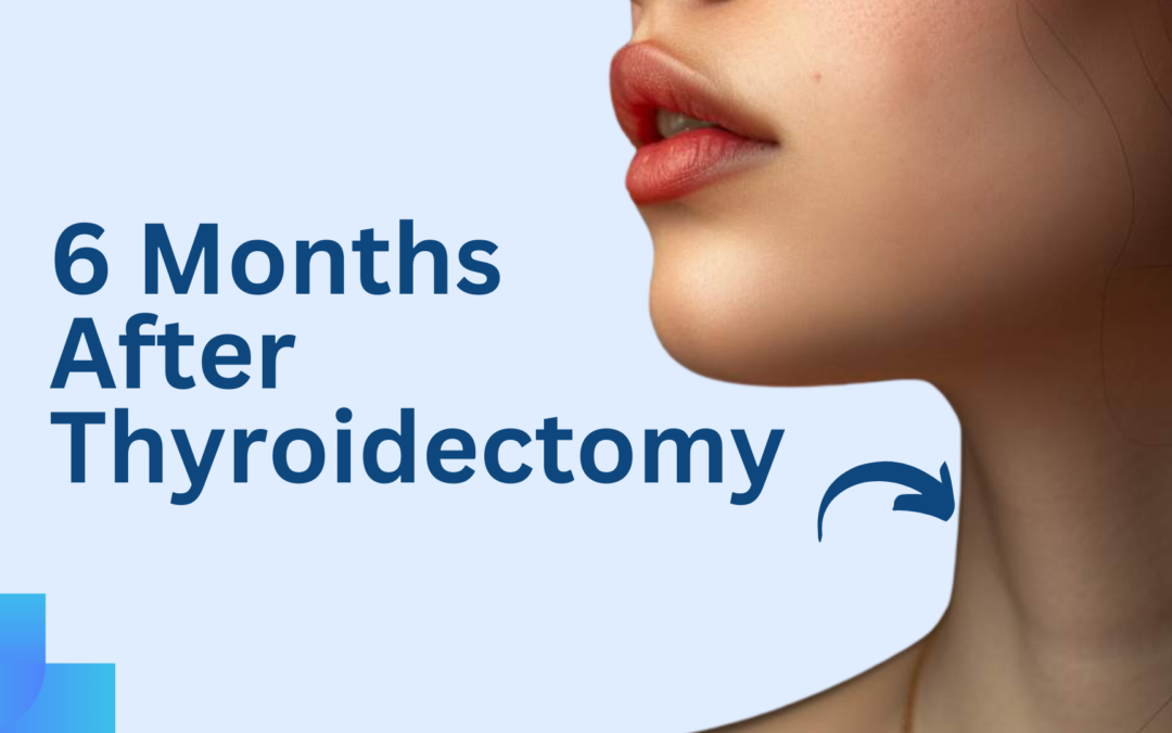 6 Months after Thyroidectomy