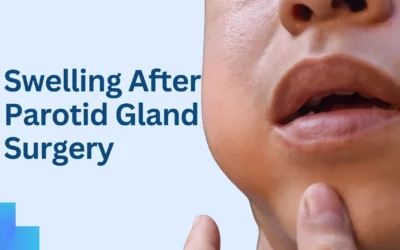 Swelling After Parotid Gland Surgery