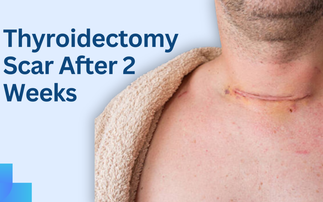 Thyroidectomy Scar After 2 Weeks