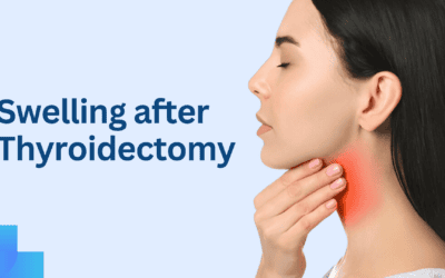 Swelling After Thyroidectomy: Causes, Recovery, and When to Seek Help